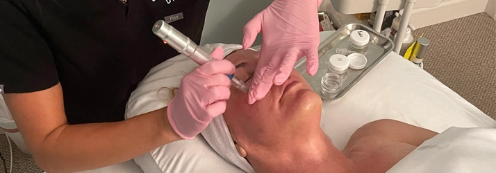 Micro needling with APSTEM-cells in Jupiter FL